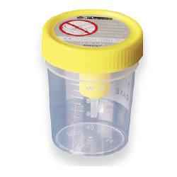 CONTENITORE URINA STERILE MEDIPRESTERIL CON SISTEMA TRANSFERT PER PROVETTE SOTTOVUOTO - FarmaLucia
